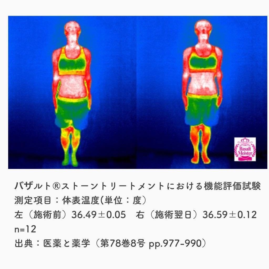 商標登録第5972921号のバザルト®ストーンを使った差別化メニューの施術風景｜婦人科医推奨・医学論文掲載